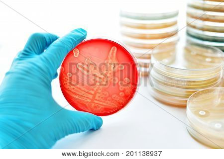 Colonies of bacteria in petri dish (blood agar)