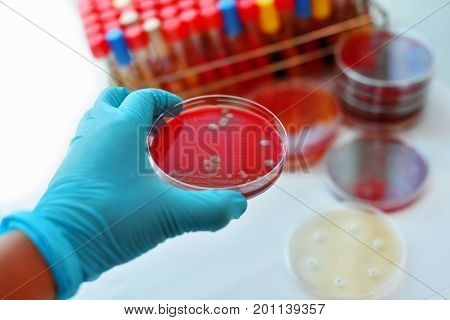 Colonies of bacteria in petri dish (culture media plate)