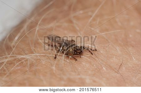 Lipoptena cervi (moose louse) extreme closeup shot