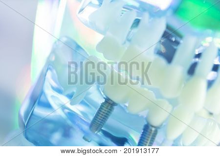Dental Teeth Dentist Impant