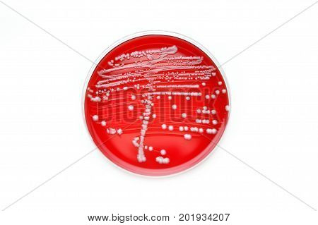 Colonies of bacteria in culture medium plate