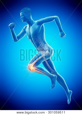3d rendered medically accurate illustration of a runners painful knee