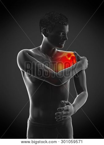 3d rendered medically accurate illustration of a painful elbow