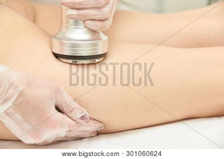 Cavitation Machine Therapy. Woman Body Lipo Treatment. Ultrasound Salon Device. Radio Frequency Cosm