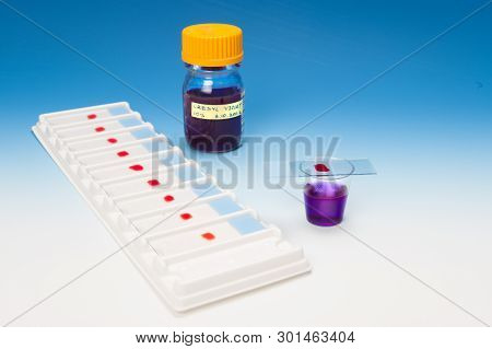 Patient Microscopic Samples And Staining Solutions On Blue-white Gradient Background