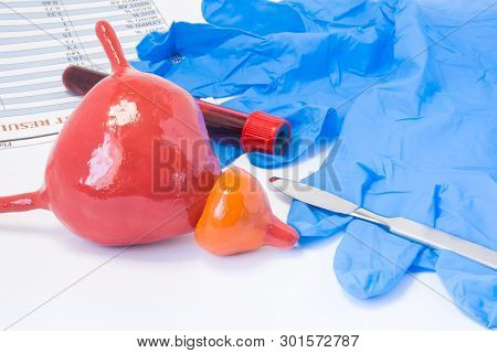 Prostate And Urine Bladder Urology Surgery Concept. Model Of Bladder With Prostate Is Near Scalpel, 