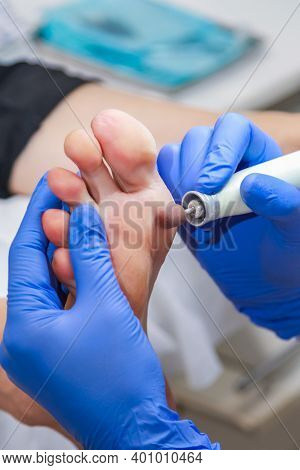 Woman Having Pedicure To Her Legs. Cares About Womans Foot Skin And Nails. Woman Filing Foot. Female