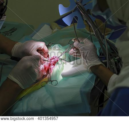 A Veterinary Surgeon Removes A Tumor From Under The Tail Of A Labrador Retiever Puppy