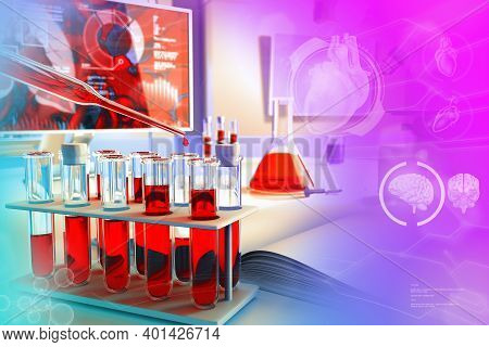 Medical 3d Illustration, Test Tubes Vials In Research Office - Blood Gene Test For Hemoglobin Or Aid