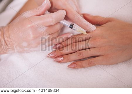 Cropped Close Up Of A Woman Getting Rejuvenating Filler Injections In Her Hand. Beautician Injecting