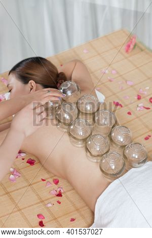 A Chinese Medicine Cupping Of The Young Lady High Quality Photo