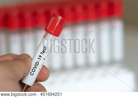 Positive Coronavirus Blood Test Concept. Analyzing Blood Sample In Test Tube For Coronavirus Test In