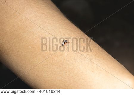 Dangerous Zica Virus Mosquito Sucking Bloode On Human Skin Cause Sick, Dengue, Chikungunya, Mayaro F