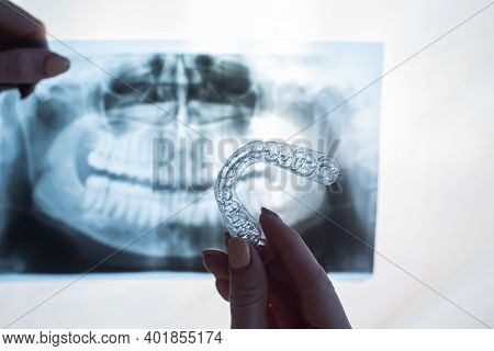 Female Hands With Transparent Mouth Guards For Correcting Bite And X-ray Of The Jaw. The Orthodontis