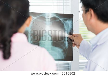 X-ray Analysis