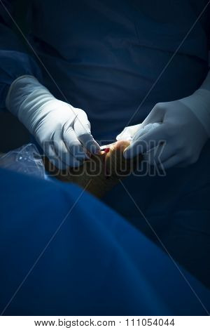 Hospital Operating Room Medical Surgery Operation