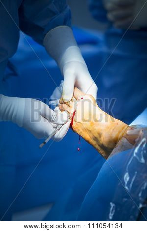Hospital Operating Room Medical Surgery Operation