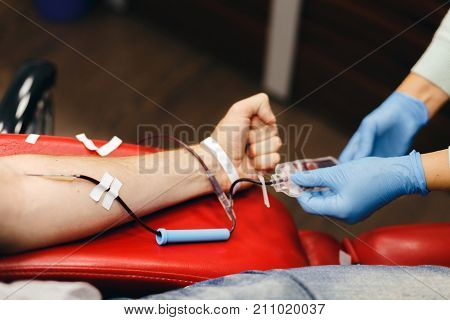 The donor blood donates blood in the clinic on a special chair. Blood sampling procedure for blood bank