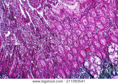 picture of a full frame duodenum cross section micrography