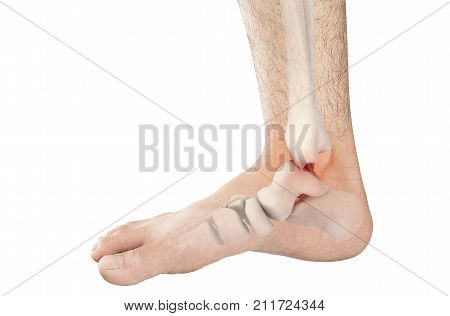foot bones pain white background foot injury