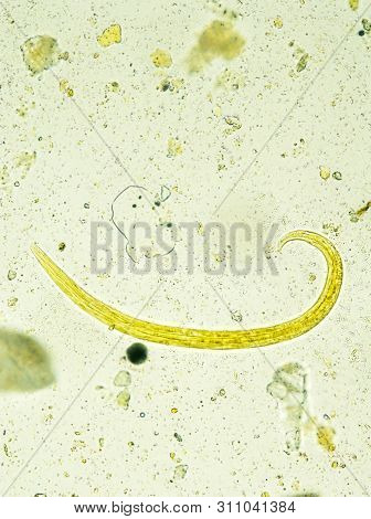 Aelurostrongylus Abstrusus Larva Isolated, Under The Microscope