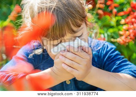Seasonal Allergy In A Child. Coryza. Selective Focus.