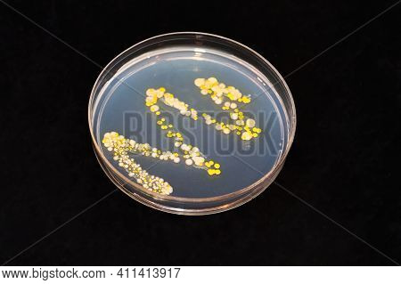 An Agar Dish With Bacteria And Fungi Colonies Against Black