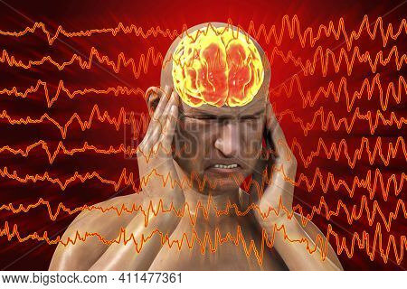 Headache, Migraine, Stroke, Conceptual 3d Illustration Showing A Man With Pain In Head On A Backgrou