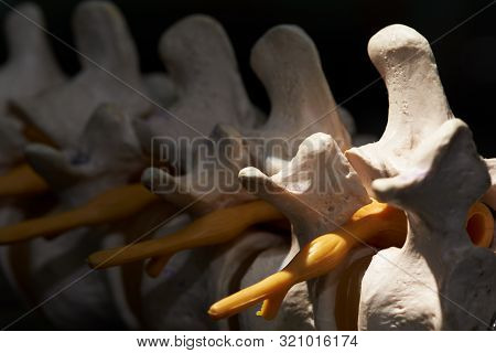 Close-up View Of Nerve Root Exiting Artificial Human Lumbar Spine Foramen Under Surgical Light Micro