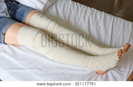 Preventive Postoperative Elastic Leg Bandage To Prevent Varicose Veins