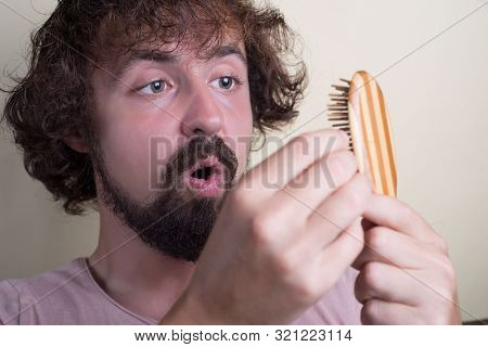 Portrait Of A Young Guy With Long Dirty Hair And Problematic Scalp. Holding A Comb With Fallen Hair