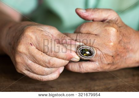 Senior Man Is Wearing Jewellery Ring In Left Ring Finger, On Wooden Background, Seborrheic Keratosis