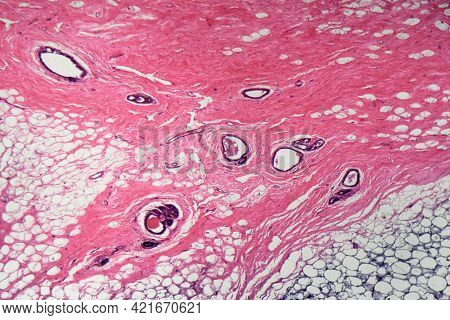 Human Mammary Gland Cells Under The Microscope