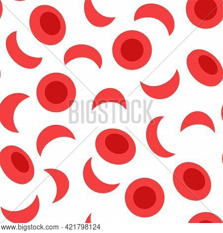 Specimen With Sickle Cells Anemia Concept. Human Blood Cells Structure Under Microscope. Microbiolog