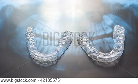 Transparent Bite Correction Trays And X-ray Of The Jaw. Orthodontist Equipment