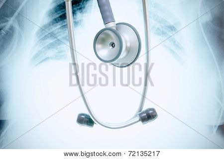 Stethoscope On A Background Of X-ray Image.