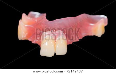 Removable Prosthesis