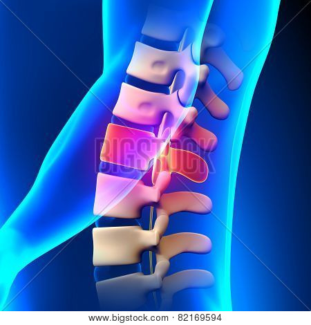 L1 Disc - Lumbar Spine