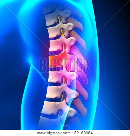 T6 Disc - Thoracic Spine Anatomy