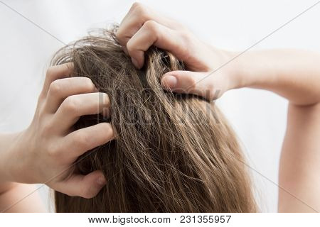 Closeup Woman Hand Itchy Scalp, Hair Care Concept