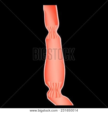 Upper Sphincter Of Esophagus. Lower Cardiac Esophageal Sphincter. Infographics. Vector Illustration 