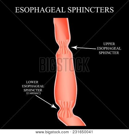 Upper Sphincter Of Esophagus. Lower Cardiac Esophageal Sphincter. Infographics. Vector Illustration 