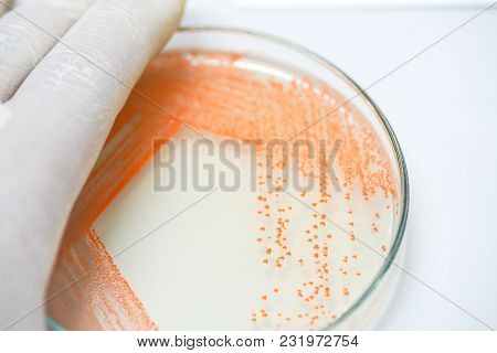 Colony Of Bacteria In Culture Medium Plate, Microbiology.