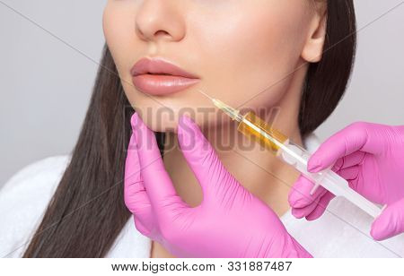 Cosmetologist Does Prp Therapy From Wrinkles On The Face Of A Woman In A Beauty Salon.cosmetology Sk