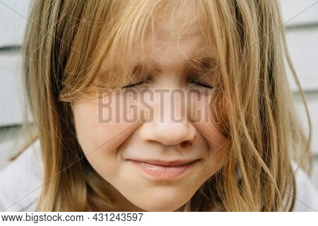 Portrait Girl With An Abrasion Under Her Eye. Child Abuse. Wounds And Abrasions