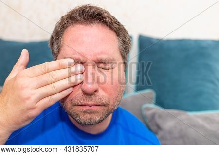 Middle Aged 45s Man Holding Hand Over His Aching Eye At Home On The Couch.closeup.