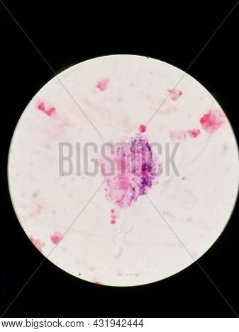 Bronchial Epithelial Cell With Oral Bacterial Contamination