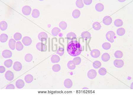 Pmn With Toxic Granule