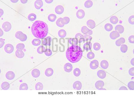 Pmn With Toxic Granule