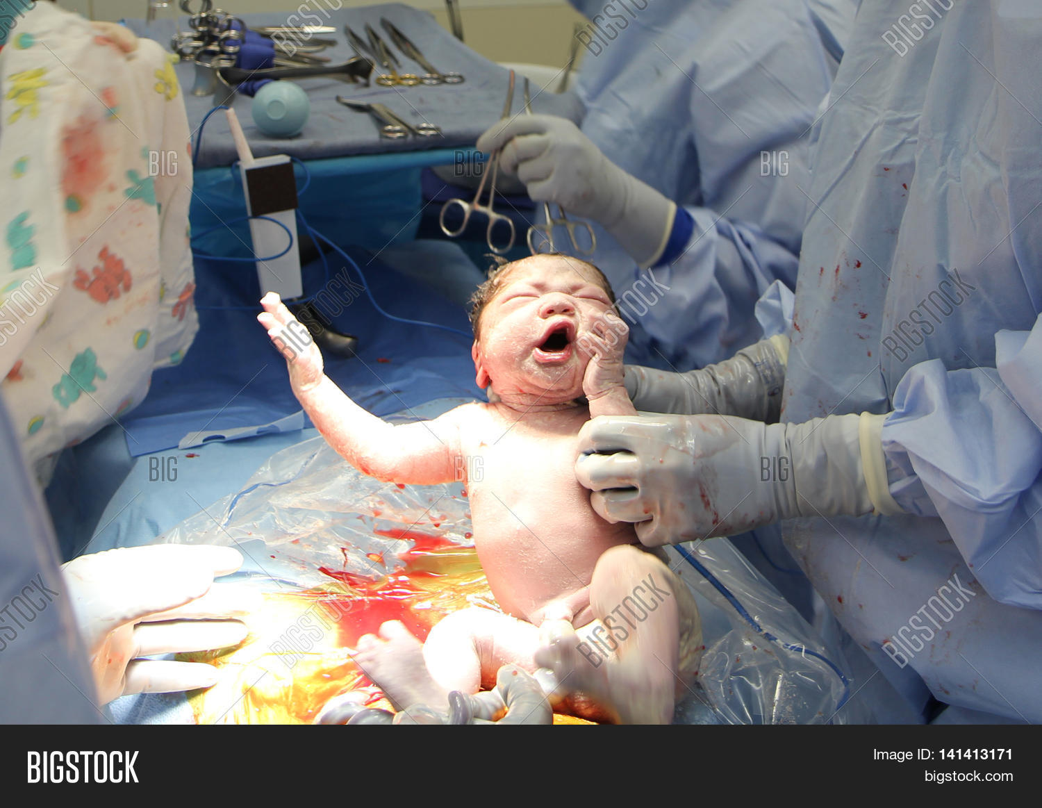 Baby Being Born Via Image Photo (Free Trial) Bigstock